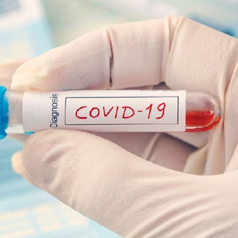 COVID-19 incubator C-CAMP is fighting coronavirus with innovative solutions
